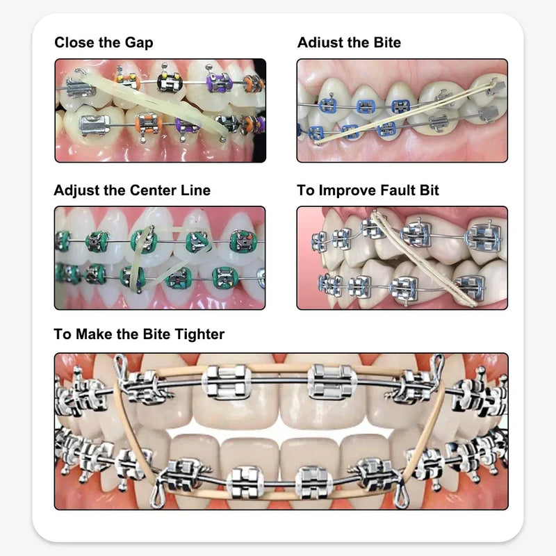 5000Pcs/Box Dental Orthodontic Zoo Pack Elastics Rubber Bands Latex Braces Force 3.5/5.0/6.5OZ Dentistry Orthodontic Materials
