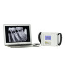 High Frequency Dental Portable X Ray Machine with LCD Touch Screen
